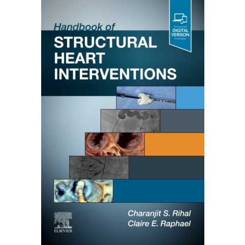 Elsevier - Health Sciences Division Handbook of Structural Heart Interventions (häftad, eng)