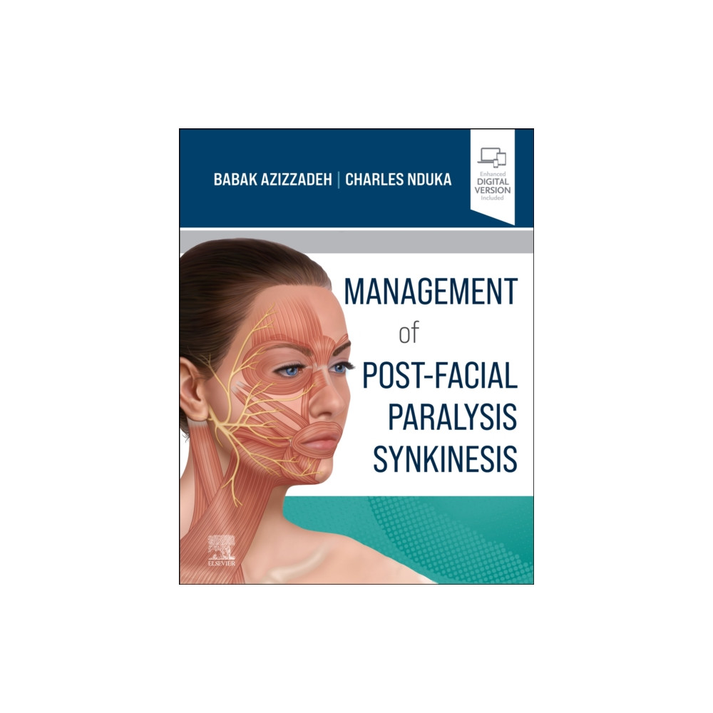 Produktbild för Management of Post-Facial Paralysis Synkinesis (inbunden, eng)