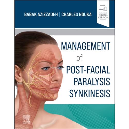 Elsevier - Health Sciences Division Management of Post-Facial Paralysis Synkinesis (inbunden, eng)
