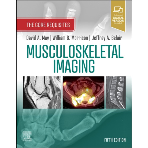 Elsevier - Health Sciences Division Musculoskeletal Imaging (häftad, eng)