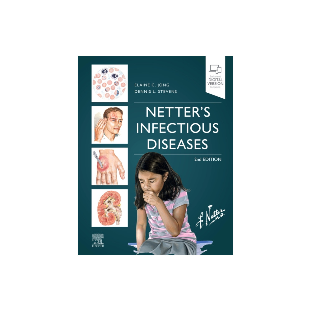 Produktbild för Netter's Infectious Diseases (inbunden, eng)