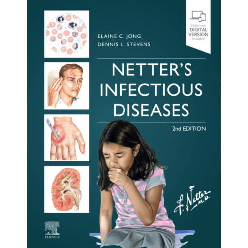 Elsevier - Health Sciences Division Netter's Infectious Diseases (inbunden, eng)