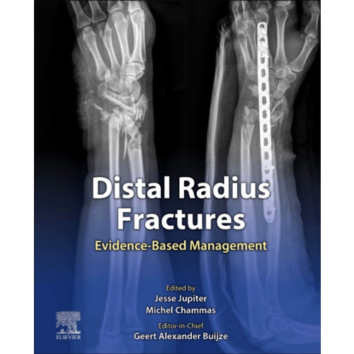 Elsevier - Health Sciences Division Distal Radius Fractures (inbunden, eng)