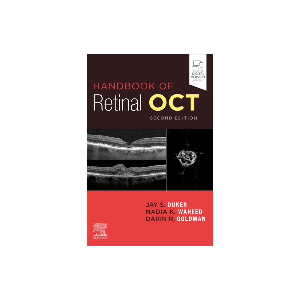 Produktbild för Handbook of Retinal OCT: Optical Coherence Tomography (häftad, eng)
