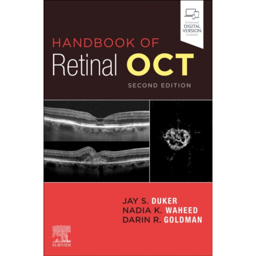Elsevier - Health Sciences Division Handbook of Retinal OCT: Optical Coherence Tomography (häftad, eng)