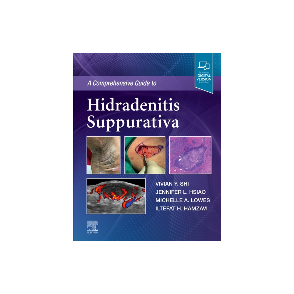 Produktbild för A Comprehensive Guide to Hidradenitis Suppurativa (inbunden, eng)