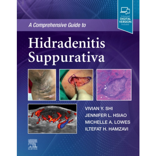 Elsevier - Health Sciences Division A Comprehensive Guide to Hidradenitis Suppurativa (inbunden, eng)