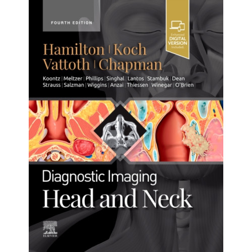 Elsevier - Health Sciences Division Diagnostic Imaging: Head and Neck (inbunden, eng)
