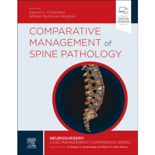 Elsevier - Health Sciences Division Comparative Management of Spine Pathology (inbunden, eng)