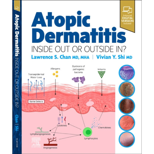 Elsevier - Health Sciences Division Atopic Dermatitis: Inside Out or Outside In (inbunden, eng)