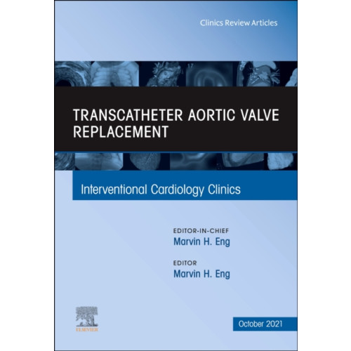 Elsevier - Health Sciences Division Transcatheter Aortic valve replacement, An Issue of Interventional Cardiology Clinics (inbunden, eng)
