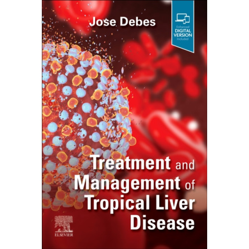 Elsevier - Health Sciences Division Treatment and Management of Tropical Liver Disease (häftad, eng)