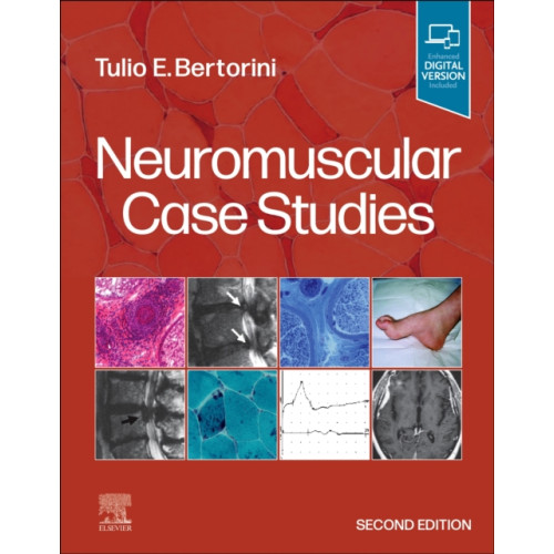 Elsevier - Health Sciences Division Neuromuscular Case Studies (häftad, eng)