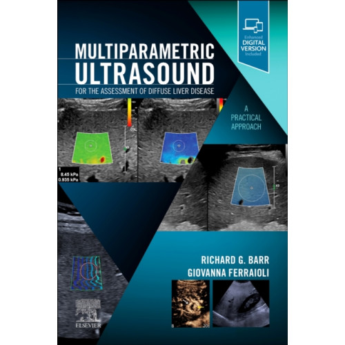 Elsevier - Health Sciences Division Multiparametric Ultrasound for the Assessment of Diffuse Liver Disease (häftad, eng)