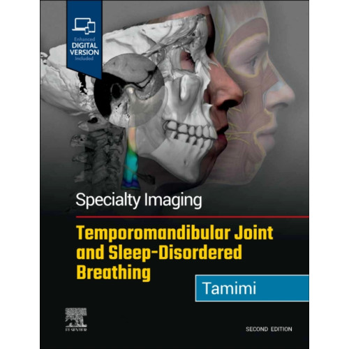 Elsevier - Health Sciences Division Specialty Imaging: Temporomandibular Joint and Sleep-Disordered Breathing (inbunden, eng)