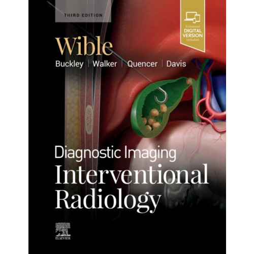 Elsevier - Health Sciences Division Diagnostic Imaging: Interventional Radiology (inbunden, eng)