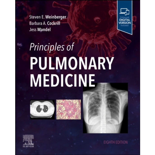 Elsevier - Health Sciences Division Principles of Pulmonary Medicine (häftad, eng)