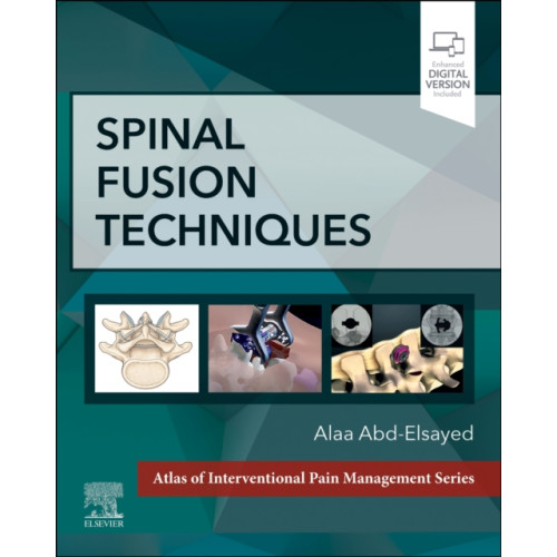 Elsevier - Health Sciences Division Spinal Fusion Techniques (inbunden, eng)