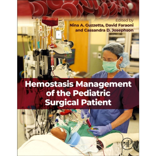 Elsevier Science & Technology Hemostasis Management of the Pediatric Surgical Patient (häftad, eng)