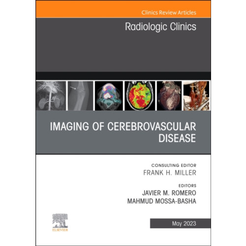 Elsevier - Health Sciences Division Imaging of Cerebrovascular Disease, An Issue of Radiologic Clinics of North America (inbunden, eng)