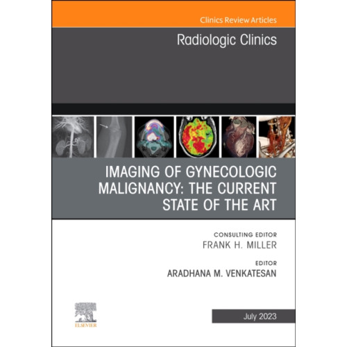 Elsevier - Health Sciences Division Imaging of Gynecologic Malignancy: The Current State of the Art, An Issue of Radiologic Clinics of North America (inbunden, eng)