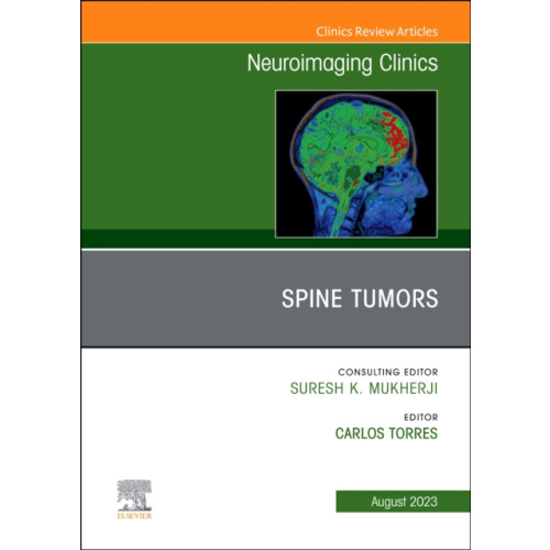 Elsevier - Health Sciences Division MRI and Traumatic Brain Injury, An Issue of Neuroimaging Clinics of North America (inbunden, eng)