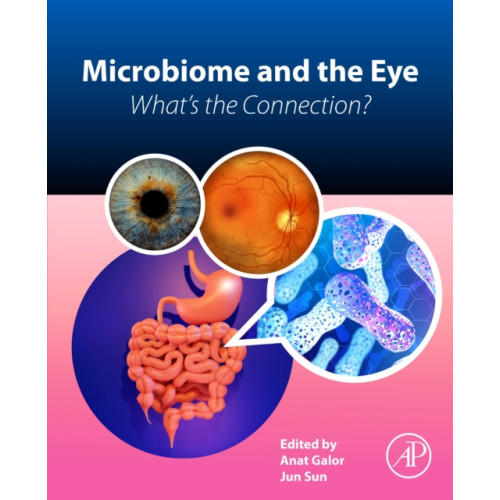 Elsevier Science & Technology Microbiome and the Eye (häftad, eng)