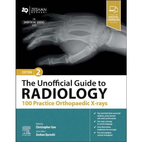 Elsevier Health Sciences The Unofficial Guide to Radiology: 100 Practice Orthopaedic X-rays (häftad, eng)