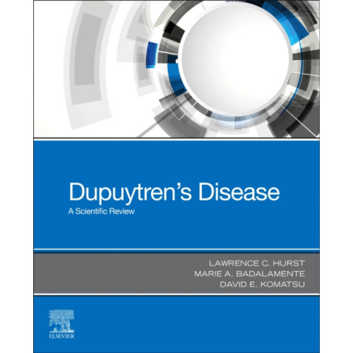 Elsevier Health Sciences Dupuytren's Disease (häftad, eng)