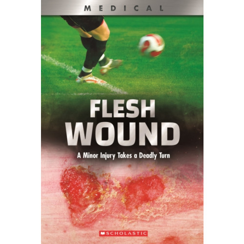 Scholastic Inc. Flesh Wound: A Minor Injury Takes a Deadly Turn (XBooks) (häftad, eng)