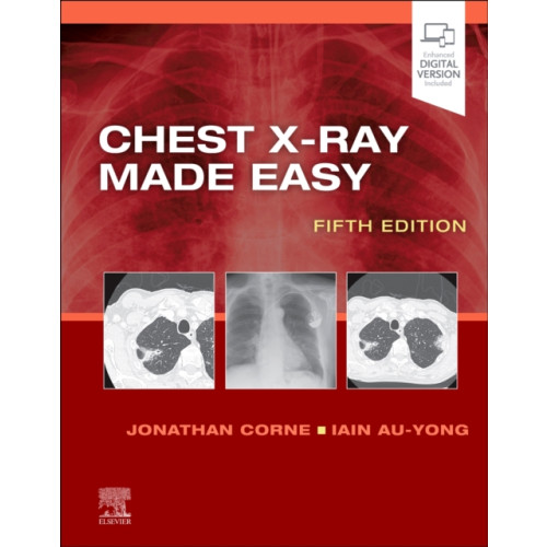 Elsevier Health Sciences Chest X-Ray Made Easy (häftad, eng)