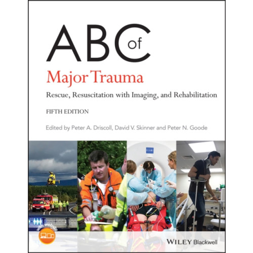 John Wiley And Sons Ltd ABC of Major Trauma (häftad, eng)