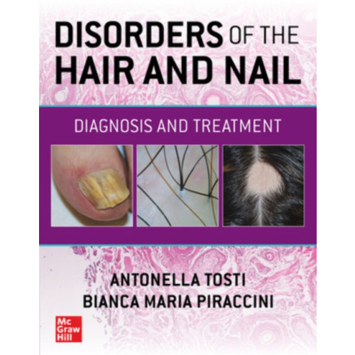 McGraw-Hill Education Disorders of the Hair and Nail: Diagnosis and Treatment (häftad, eng)