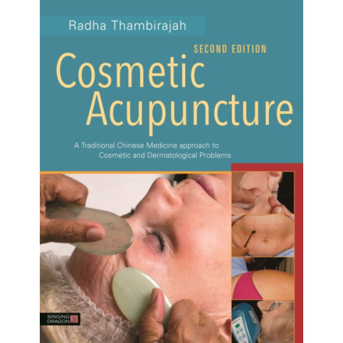 Jessica kingsley publishers Cosmetic Acupuncture, Second Edition (häftad, eng)