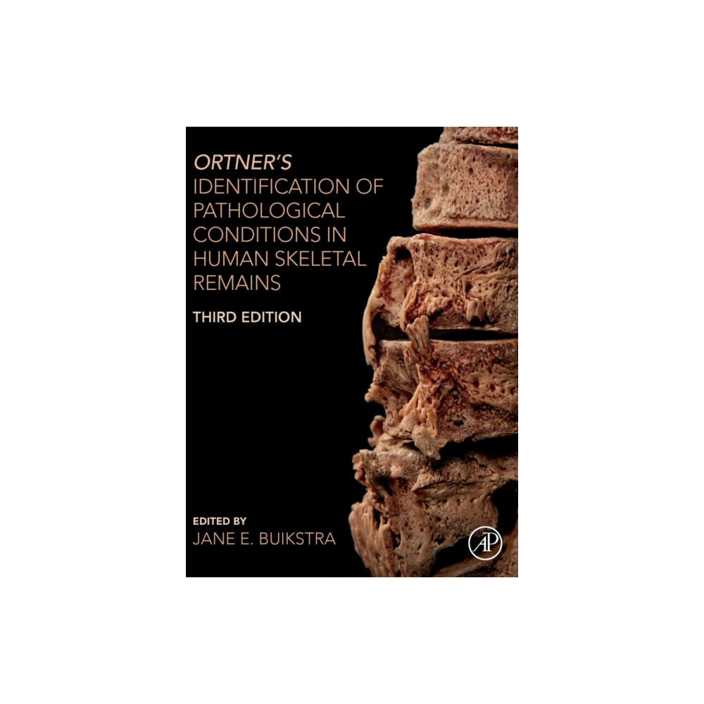 Produktbild för Ortner's Identification of Pathological Conditions in Human Skeletal Remains (inbunden, eng)