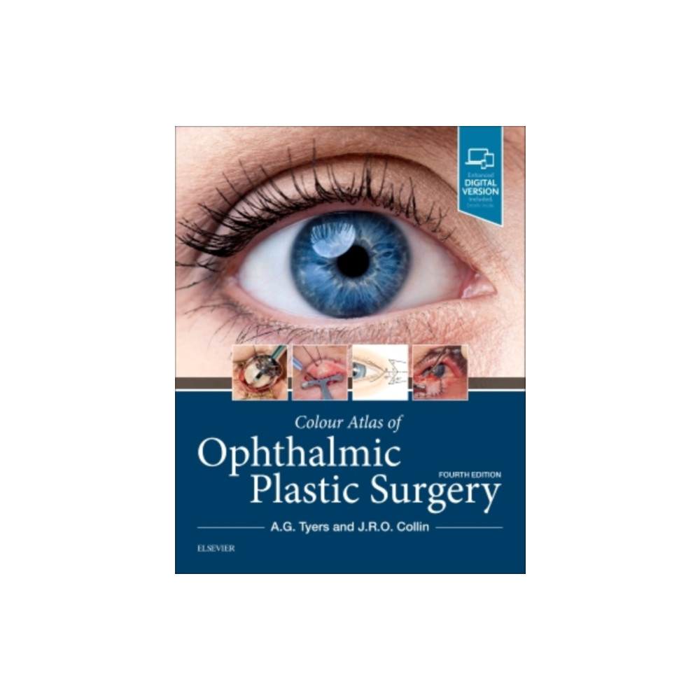 Produktbild för Colour Atlas of Ophthalmic Plastic Surgery (inbunden, eng)