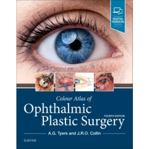 Elsevier - Health Sciences Division Colour Atlas of Ophthalmic Plastic Surgery (inbunden, eng)