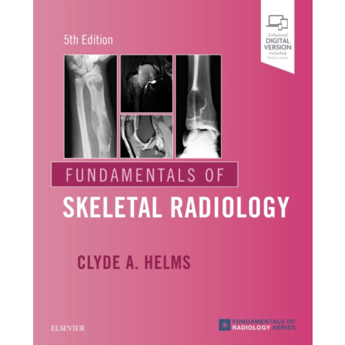 Elsevier - Health Sciences Division Fundamentals of Skeletal Radiology (häftad, eng)