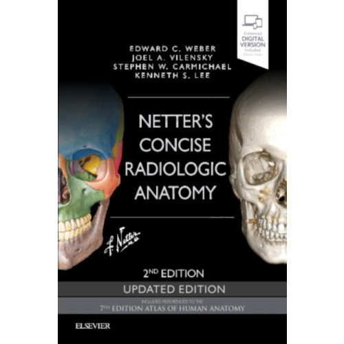 Elsevier - Health Sciences Division Netter's Concise Radiologic Anatomy Updated Edition (häftad, eng)