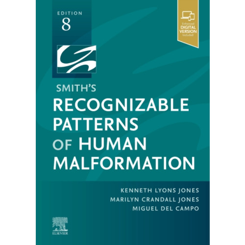 Elsevier - Health Sciences Division Smith's Recognizable Patterns of Human Malformation (inbunden, eng)
