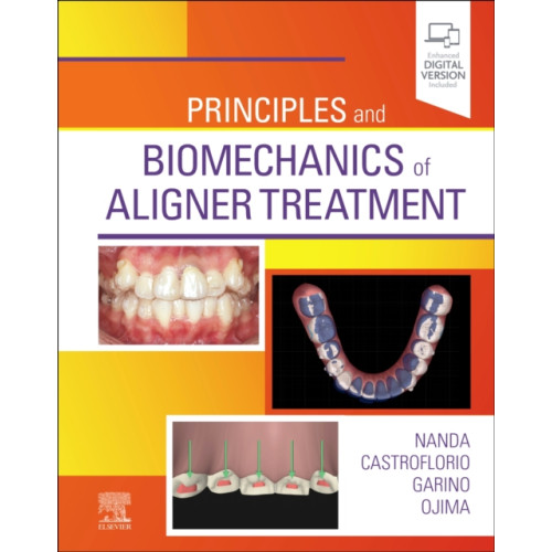 Elsevier - Health Sciences Division Principles and Biomechanics of Aligner Treatment (inbunden, eng)
