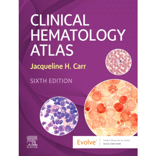 Elsevier - Health Sciences Division Clinical Hematology Atlas (bok, spiral, eng)