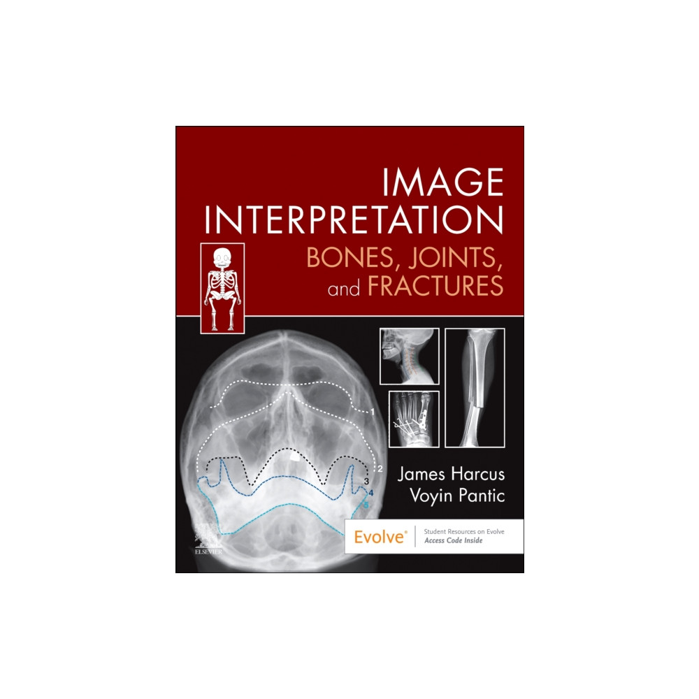 Produktbild för Image Interpretation: Bones, Joints, and Fractures (häftad, eng)