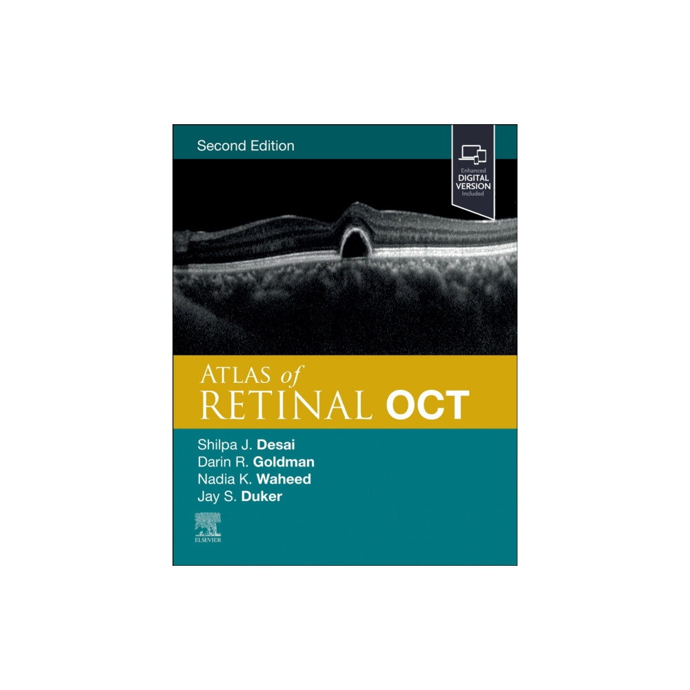 Produktbild för Atlas of Retinal OCT (inbunden, eng)