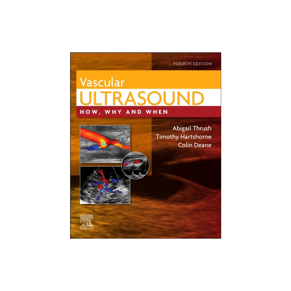 Produktbild för Vascular Ultrasound (inbunden, eng)