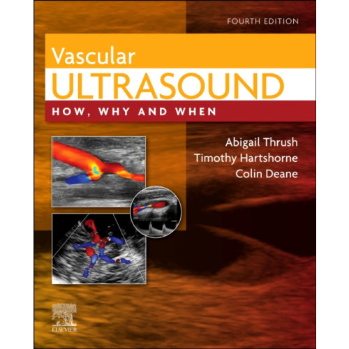 Elsevier Health Sciences Vascular Ultrasound (inbunden, eng)