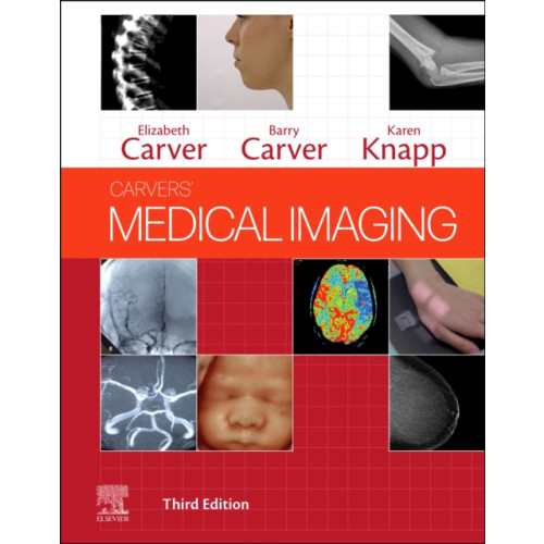 Elsevier Health Sciences Carvers' Medical Imaging (inbunden, eng)