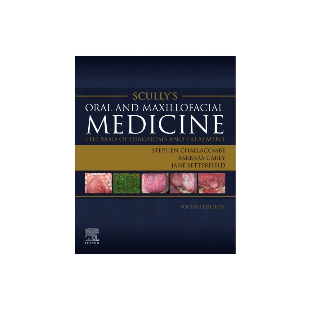Produktbild för Scully's Oral and Maxillofacial Medicine: The Basis of Diagnosis and Treatment (häftad, eng)