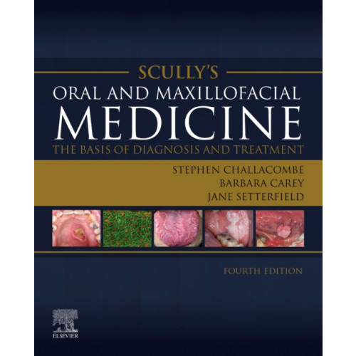 Elsevier Health Sciences Scully's Oral and Maxillofacial Medicine: The Basis of Diagnosis and Treatment (häftad, eng)