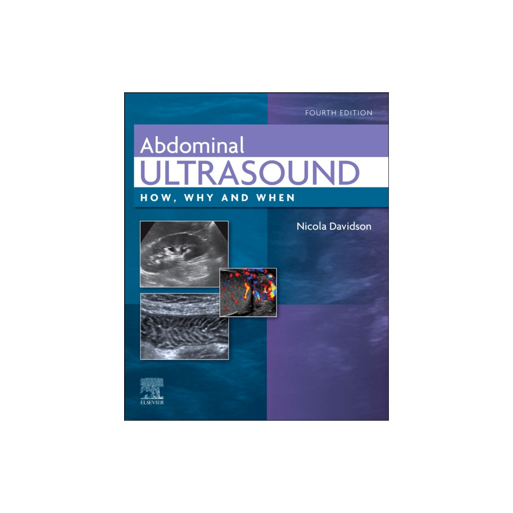 Produktbild för Abdominal Ultrasound (inbunden, eng)